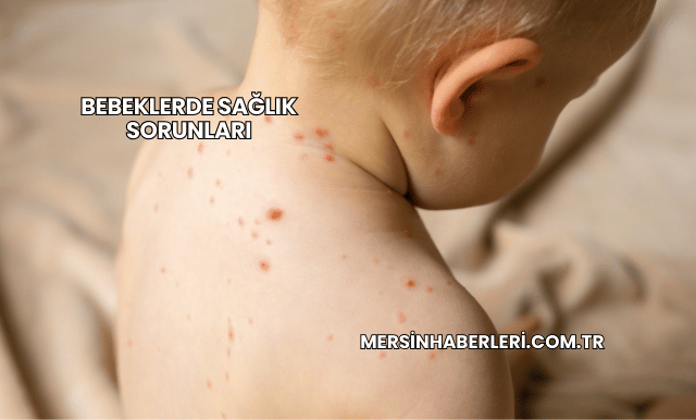 Bebeklerde Sağlık Sorunları