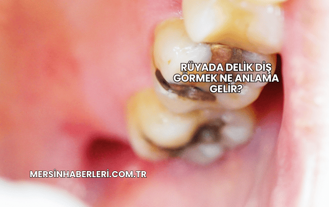 Rüyada Delik Diş Görmek Ne Anlama Gelir?