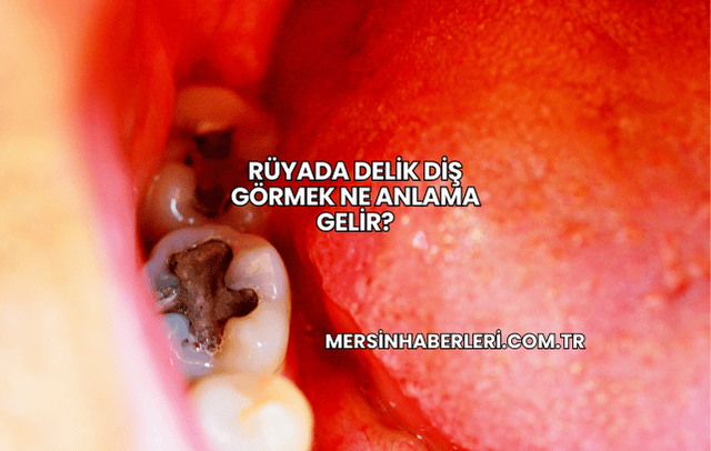 Rüyada Delik Diş Görmek Ne Anlama Gelir?