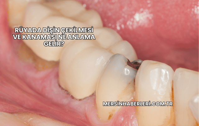 Rüyada Dişin Çekilmesi ve Kanaması Ne Anlama Gelir?