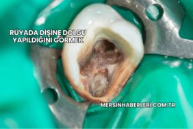 Rüyada Dişine Dolgu Yapıldığını Görmek
