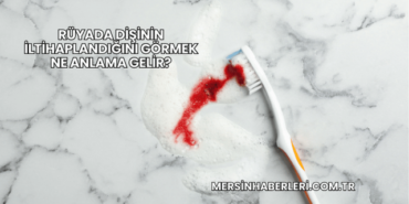 Rüyada Dişinin İltihaplandığını Görmek Ne Anlama Gelir?