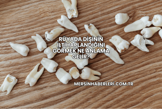 Rüyada Dişinin İltihaplandığını Görmek Ne Anlama Gelir?