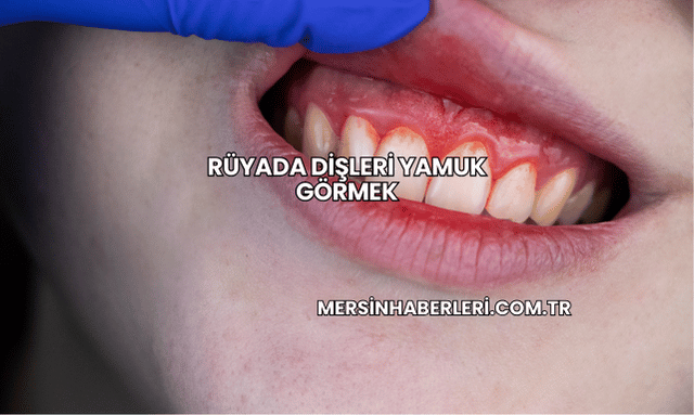 Rüyada Dişleri Yamuk Görmek