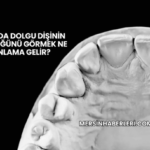 Rüyada Dolgu Dişinin Düştüğünü Görmek Ne Anlama Gelir?