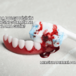 Rüyada Dolgu Dişinin Kırıldığını Görmek Ne Anlama Gelir?