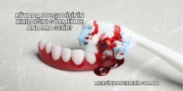 Rüyada Dolgu Dişinin Kırıldığını Görmek Ne Anlama Gelir?