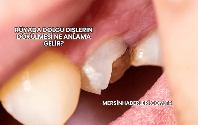 Rüyada Dolgu Dişlerin Dökülmesi Ne Anlama Gelir?